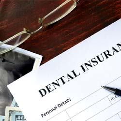 Dental Insurance form for dental implants in Mission Viejo