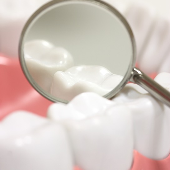 Closeup of teeth with dental sealants