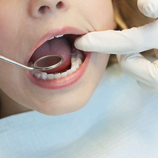 Dentist checking young patient's tooth colored fillings