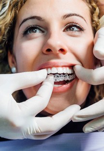 patient getting Invisalign near Laguna Niguel