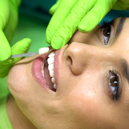 dentist placing a veneer on a patient’s tooth