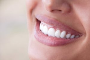 Closeup of patient's smile after learning about maintaining your veneers